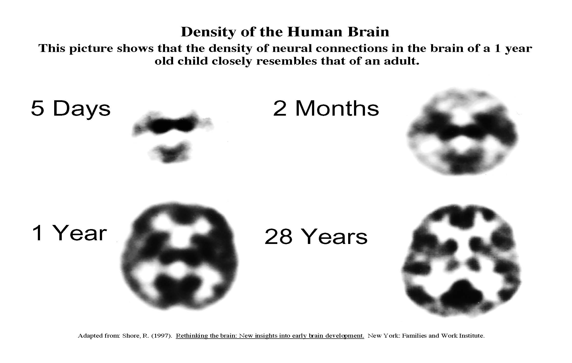 "Density of the human brain"